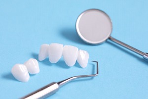 Porcelain veneers, which are commonly part of smile makeovers