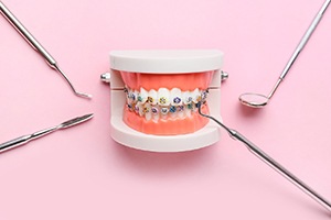 Colorful braces on dental model against pink background