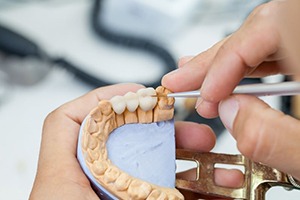 Dental lab technician working on dental bridge