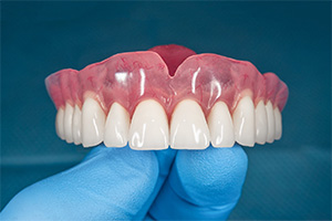 Gloved hand holding full denture for upper arch