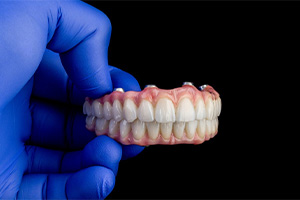 Gloved hand holding full set of implant dentures against dark background