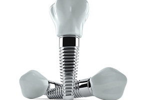 Three dental implants and crowns against white background
