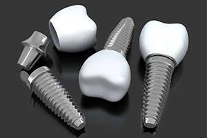 Three animated dental implant supported replacement teeth