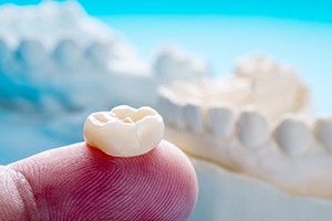 Metal-free crown on fingertip in foreground, dental molds in background