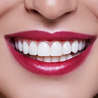 Closeup of beautiful smile after crown lengthening surgerhy