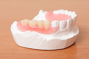 Model smile with partial denture