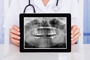 Dentist holding up digital x-rays