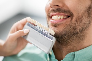 Man's smile compared with porcelain veneer shade chart