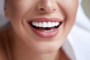 Beautiful teeth thanks to diet change with porcelain veneers