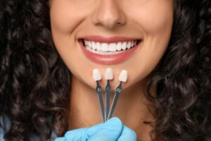 Samples from dental shade guide next to woman&rsquo;s smile 